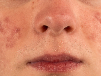 201303061718549917 201303061718549917